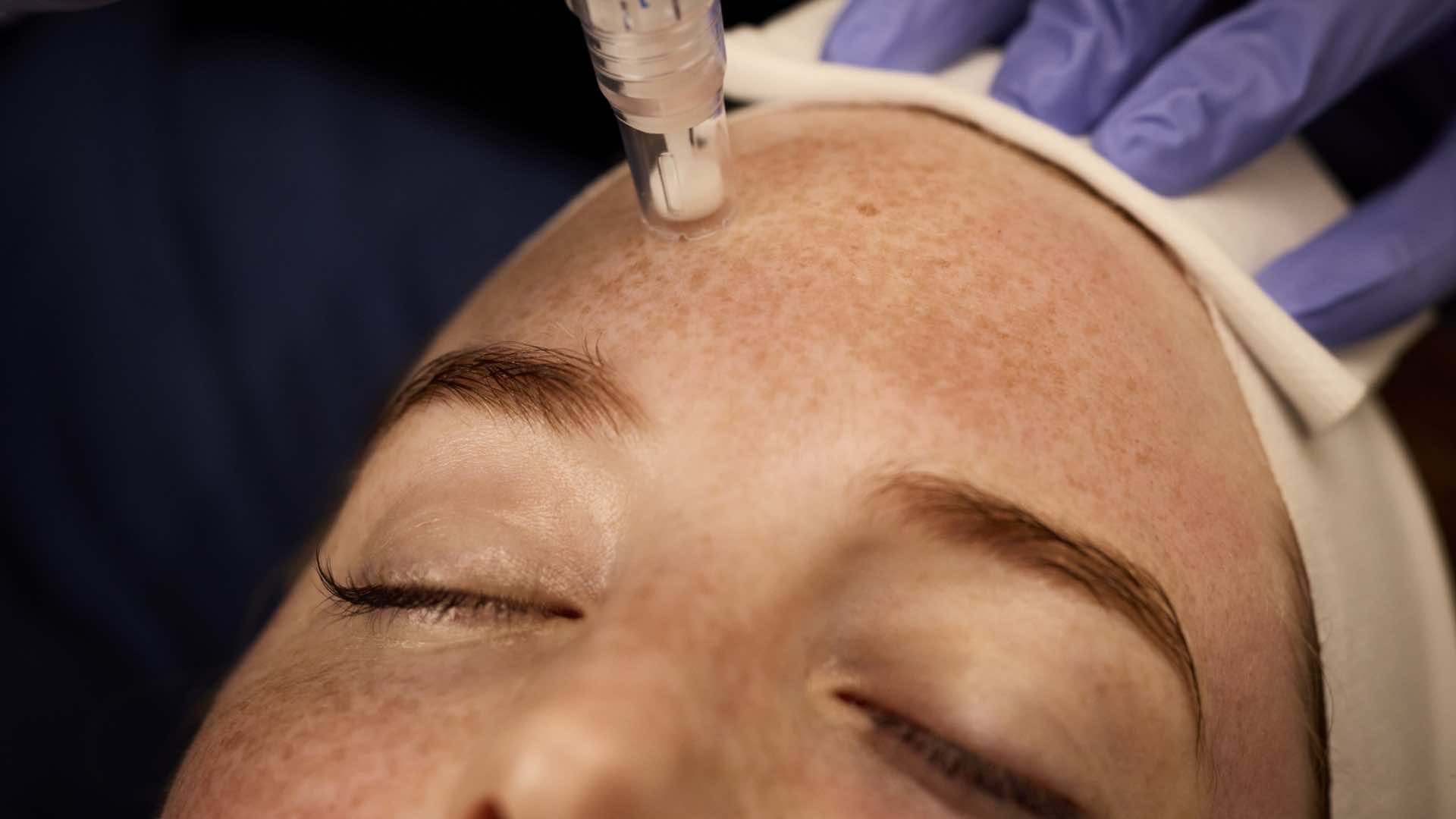 Treatment in session